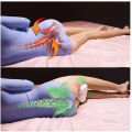 Poduszka ortopedyczna między nogi do spania separator - zdjęcie 3